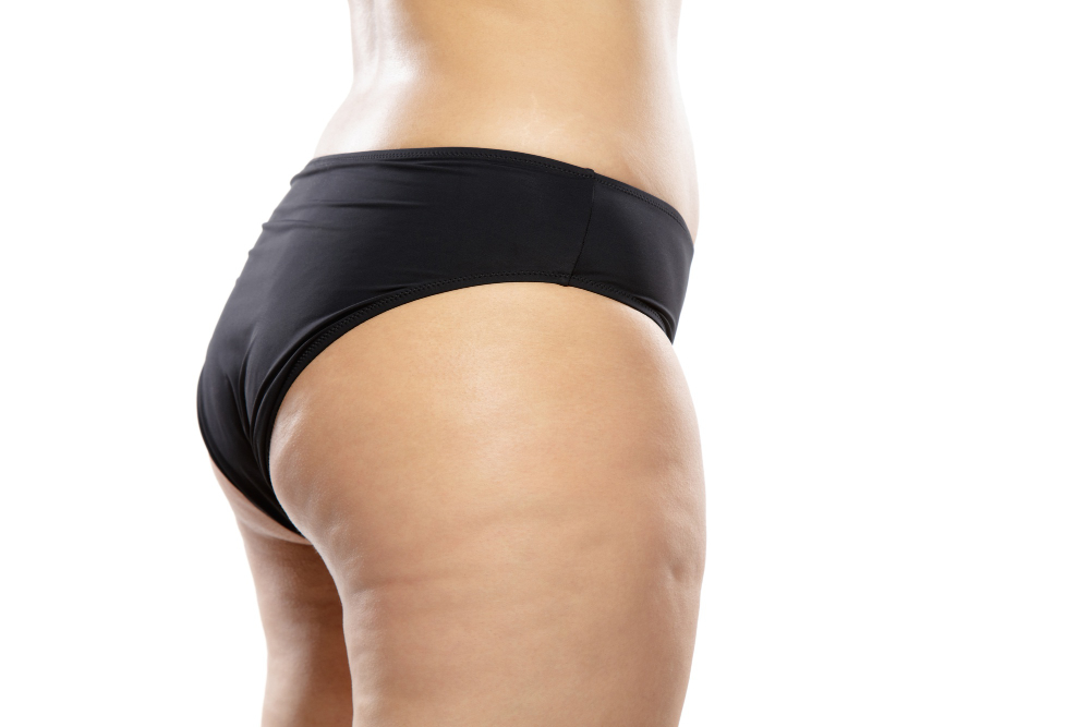 This Painless Cellulite Treatment is Considered the Best by Experts!
