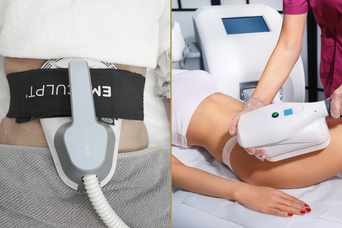 Emsculpt vs. CoolSculpting: Crafting Your Perfect Contour at Akara By Aayna Clinic